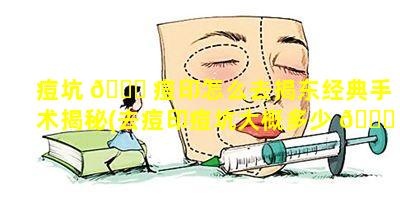 痘坑 🐝 痘印怎么去揭东经典手术揭秘(去痘印痘坑大概多少 🐎 钱)